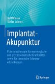 Implantat-Akupunktur (eBook, PDF)