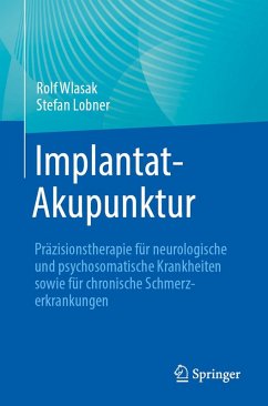 Cover Implantat-Akupunktur (eBook, PDF)