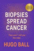 Biopsies Spread Cancer (eBook, ePUB)