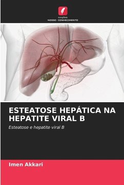 Cover ESTEATOSE HEPÁTICA NA HEPATITE VIRAL B