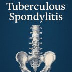 Tuberculous spondylitis (eBook, ePUB)