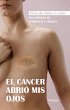 El cáncer abrió mis ojos (eBook, ePUB) - Bild 1