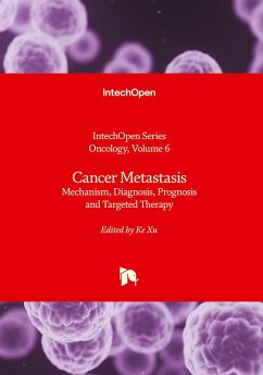 Cancer Metastasis - Mechanism, Diagnosis, Prognosis and Targeted Therapy