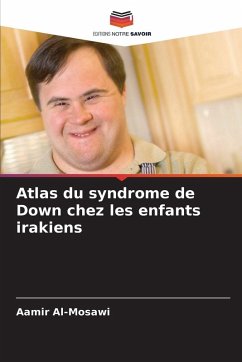 Cover Atlas du syndrome de Down chez les enfants irakiens