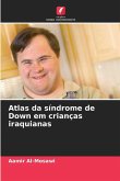 Atlas da síndrome de Down em crianças iraquianas