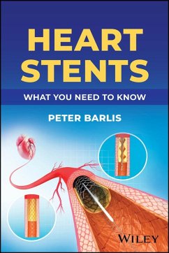 Cover Heart Stents (eBook, ePUB)