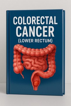 Cover Colorectal Cancer (Lower Rectum) (eBook, ePUB)