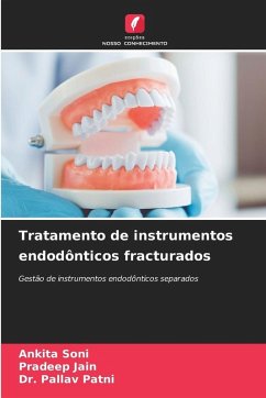 Tratamento de instrumentos endodônticos fracturados Cover Tratamento de instrumentos endodônticos fracturados