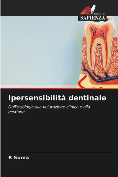 Ipersensibilità dentinale Ipersensibilità dentinale