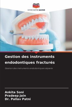 Cover Gestion des instruments endodontiques fracturés