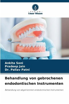 Cover Behandlung von gebrochenen endodontischen Instrumenten