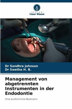 Cover Management von abgetrennten Instrumenten in der Endodontie