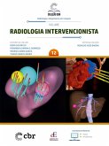 Coleção CBR Volume 12 - Radiologia Intervencionista (eBook, ePUB)