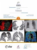 Coleção CBR Volume 13 - Tórax (eBook, ePUB)