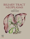 Biliary Tract Neoplasms (eBook, ePUB)