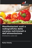 Manifestazioni orali e radiografiche delle carenze nutrizionali e dell'alimentazione Manifestazioni orali e radiografiche delle carenze nutrizionali e dell'alimentazione