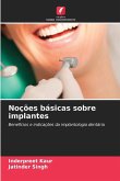 Noções básicas sobre implantes Noções básicas sobre implantes