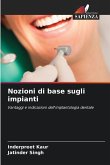 Nozioni di base sugli impianti Nozioni di base sugli impianti