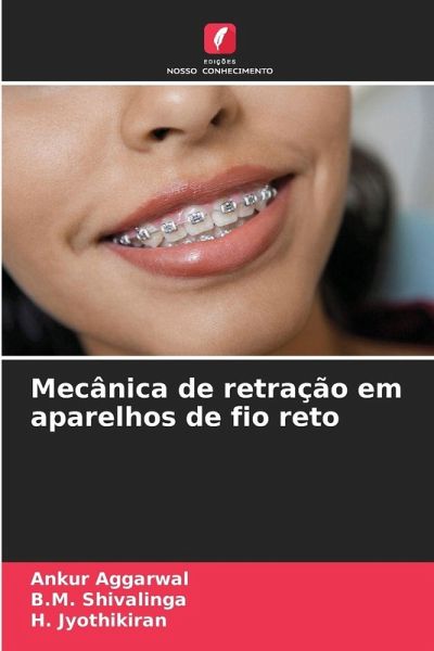 Mecânica de retração em aparelhos de fio reto Mecânica de retração em aparelhos de fio reto