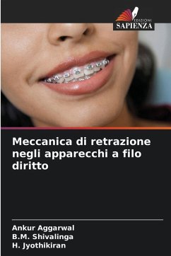 Cover Meccanica di retrazione negli apparecchi a filo diritto