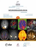 Coleção CBR Volume 8 - Neurorradiologia (eBook, ePUB)