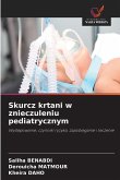 Skurcz krtani w znieczuleniu pediatrycznym