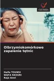 Olbrzymiokomórkowe zapalenie t¿tnic Olbrzymiokomórkowe zapalenie t¿tnic