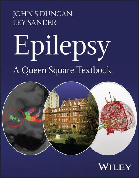 Epilepsy