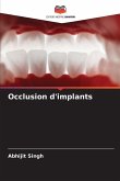 Occlusion d'implants Occlusion d'implants