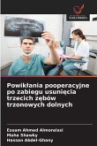 Powik¿ania pooperacyjne po zabiegu usuni¿cia trzecich z¿bów trzonowych dolnych