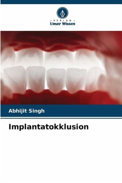 Cover Implantatokklusion