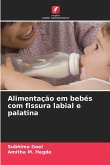 Alimentação em bebés com fissura labial e palatina Alimentação em bebés com fissura labial e palatina
