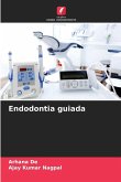 Endodontia guiada Endodontia guiada