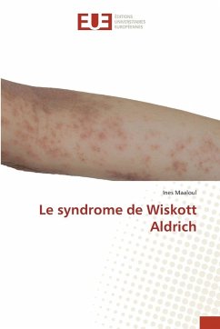 Cover Le syndrome de Wiskott Aldrich