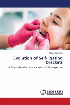 Evolution of Self-ligating brackets Evolution of Self-ligating brackets