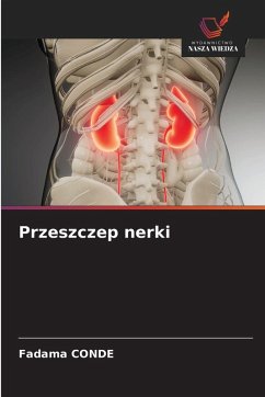 Przeszczep nerki - CONDE, Fadama Przeszczep nerki - CONDE, Fadama