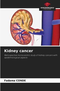 Kidney cancer - CONDE, Fadama Kidney cancer - CONDE, Fadama