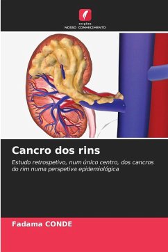 Cancro dos rins - CONDE, Fadama
