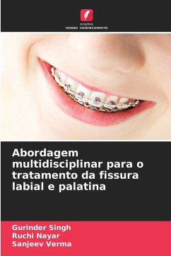 Cover Abordagem multidisciplinar para o tratamento da fissura labial e palatina