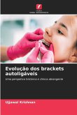 Evolução dos brackets autoligáveis