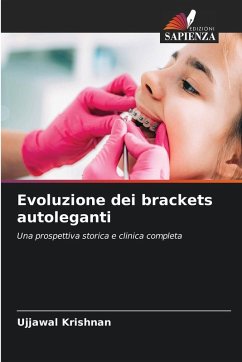 Evoluzione dei brackets autoleganti Cover Evoluzione dei brackets autoleganti