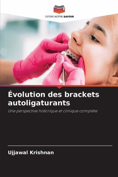 Évolution des brackets autoligaturants - Krishnan, Ujjawal Évolution des brackets autoligaturants - Krishnan, Ujjawal