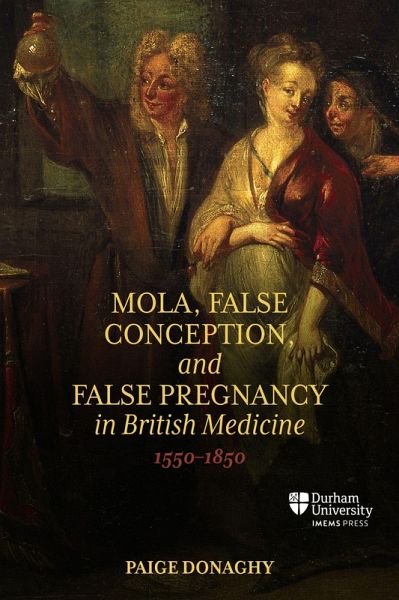 Mola, False Conception, and False Pregnancy in British Medicine, 1550-1850 Mola, False Conception, and False Pregnancy in British Medicine, 1550-1850