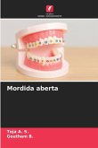 Mordida aberta