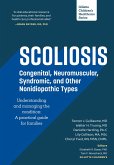 Scoliosis: Congenital, Neuromuscular, Syndromic and other Nonidiopathic Types (eBook, ePUB)