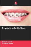 Brackets ortodônticos