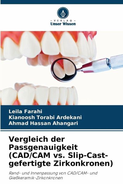 Vergleich der Passgenauigkeit (CAD/CAM vs. Slip-Cast-gefertigte Zirkonkronen) Vergleich der Passgenauigkeit (CAD/CAM vs. Slip-Cast-gefertigte Zirkonkronen)