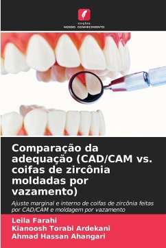 Cover Comparação da adequação (CAD/CAM vs. coifas de zircônia moldadas por vazamento)
