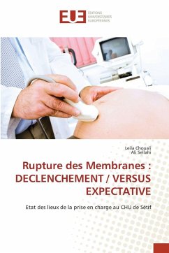 Cover Rupture des Membranes : DECLENCHEMENT / VERSUS EXPECTATIVE