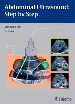 Cover Abdominal Ultrasound: Step by Step (eBook, ePUB)